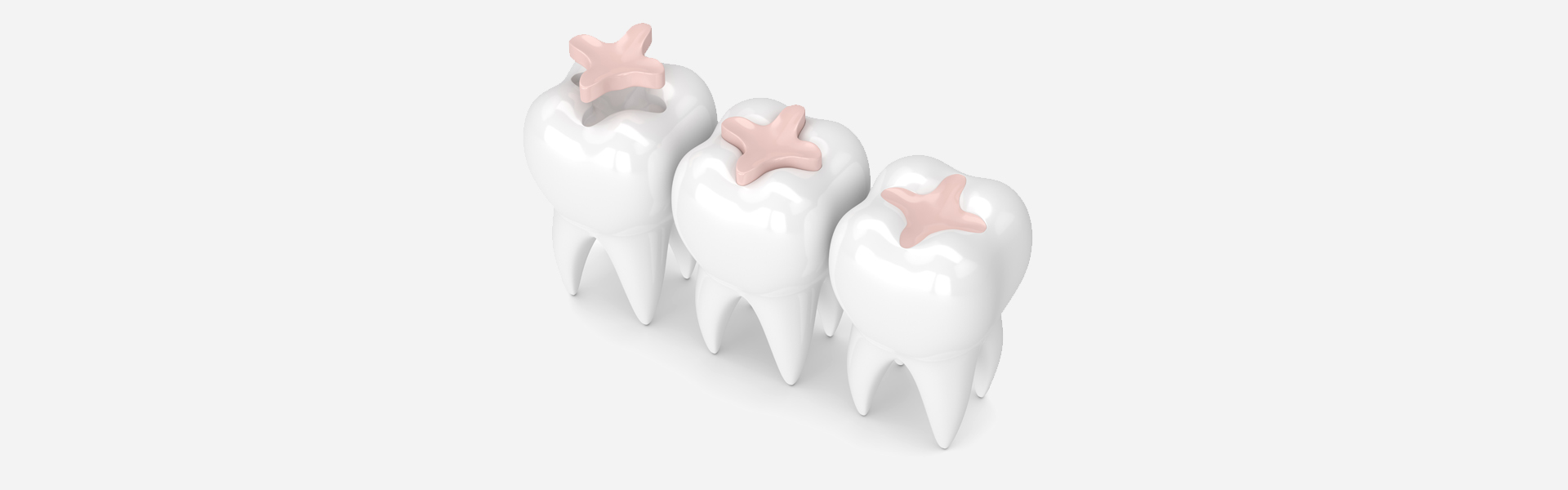 Why Are Dental Fillings Essential for Tooth Decay?