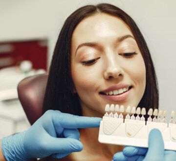 What to Do After Getting Dental Veneers: Essential Tips for Optimal Results